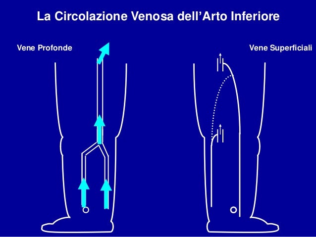 Vene varicose con insolvenza