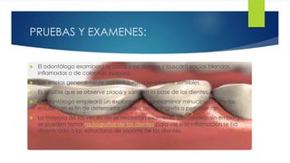 PRUEBAS Y EXAMENES: 
 El odontólogo examinará la boca y los dientes y buscará encías blandas, 
inflamadas o de color rojo púrpura. 
 Las encías generalmente son indoloras o levemente sensibles. 
 Es posible que se observe placa y sarro en la base de los dientes. 
 El odontólogo empleará un explorador para examinar minuciosamente las 
encías con el fin de determinar si usted tiene gingivitis o periodontitis. 
 La mayoría de las veces, no se necesitan exámenes adicionales; sin embargo, 
se pueden tomar radiografías de los dientes para ver si la inflamación se ha 
diseminado a las estructuras de soporte de los dientes. 
 