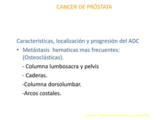 CANCER DE PRÓSTATA
Características, localización y progresión del ADC
• Metástasis hematicas mas frecuentes:
(Osteoclásticas).
- Columna lumbosacra y pelvis
- Caderas.
-Columna dorsolumbar.
-Arcos costales.
Campbell. 2005. 8ª edición. Tomo 4. pp. 3314-3315
 