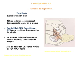 CANCER DE PRÓSTATA
Métodos de diagnóstico
Tacto Rectal
- Evalúa extensión local
- 25% de lesiones sospechosas al
tacto presenta cáncer en la biopsia
- Sensibilidad: 52% Especificidad:
81% como predictor de enfermedad
localizada
- TR anormal independientemente
del valor de PSA, se recomienda
biopsia
- 25% de pctes con CaP tienen niveles
de PSA < DE 4 ng/ml
Campbell. 2005. 8ª edición. Tomo 4. pp. 3356-3361
An Atlas of Prostatic Diseases. Third edition. Pp 72.
 
