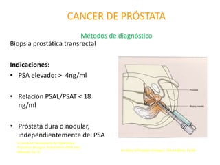 CANCER DE PRÓSTATA
Métodos de diagnóstico
Biopsia prostática transrectal
Indicaciones:
• PSA elevado: > 4ng/ml
• Relación PSAL/PSAT < 18
ng/ml
• Próstata dura o nodular,
independientemente del PSA
An Atlas of Prostatic Diseases. Third edition. Pp 84.
II Consenso Venezolano de Hiperplasia
Prostática Benigna. Septiembre-2004. Edo.
Miranda. Pp 12
 
