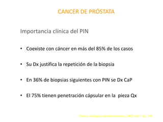CANCER DE PRÓSTATA
Importancia clínica del PIN
• Coexiste con cáncer en más del 85% de los casos
• Su Dx justifica la repetición de la biopsia
• En 36% de biopsias siguientes con PIN se Dx CaP
• El 75% tienen penetración cápsular en la pieza Qx
Clínicas Urológicas de Norteamérica. 2003. Vol 2. Pp. 178
 