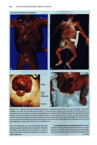 Embriologia Lagman 11 Edicion