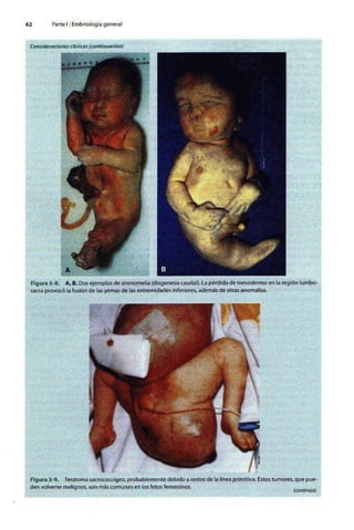 Embriologia Lagman 11 Edicion