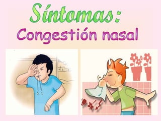 Síntomas: Congestión nasal 