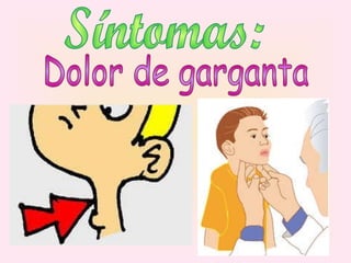 Síntomas: Dolor de garganta 