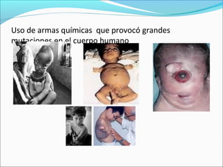 Uso de armas químicas que provocó grandes
mutaciones en el cuerpo humano
 