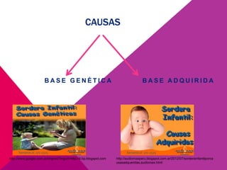 CAUSAS
B A S E G E N É T I C A B A S E A D Q U I R I D A
http://www.google.com.ar/imgres?imgurl=http://4.bp.blogspot.com http://audiomaxperu.blogspot.com.ar/2012/07/sorderainfantilporca
usasadqueridas.audiomax.html
 