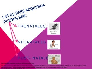 PRENATALES.
NEONATALES.
POST- NATALES.
http://salusvision.com/Front/BuscarVideos/buscaVideos/_lNsCCvReMJ5dhwYAbcRIXQGHpilbLJhQYDWJ-TfiFM3sXIuoG4AzU4C1DNVa19L9l-
pAL9xHd9TZ3Wt2_zPBvP53rwA1Fj6HhLlppNb6ZR5wvxC3nqf4OBoOj0ROTU2_nRifoQxkJCbpsMY1InC84FT-
http://del-bebe.blogspot.com.ar/2014/04/meningitis.html
 