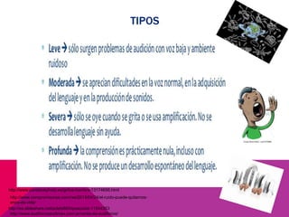 TIPOS
http://es.slideshare.net/pcletii88/hipoacusia-11044353
http://www.compromisorse.com/rse/2013/04/24/el-ruido-puede-quitarnos-
anos-de-vida/
http://www.audifonosaudimex.com.ar/venta-de-audifonos/
http://www.canstockphoto.es/gritos-hombre-13174656.html
 
