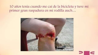 10 años tenia cuando me caí de la bicicleta y tuve mi
primer gran raspadura en mi rodilla auch…
 