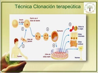 Técnica Clonación terapeútica 
 