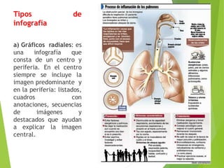 Tipos de
infografía
a) Gráficos radiales: es
una infografía que
consta de un centro y
periferia. En el centro
siempre se incluye la
imagen predominante y
en la periferia: listados,
cuadros con
anotaciones, secuencias
de imágenes y
destacados que ayudan
a explicar la imagen
central.
 