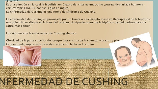 enfermedades del sistema endocrino