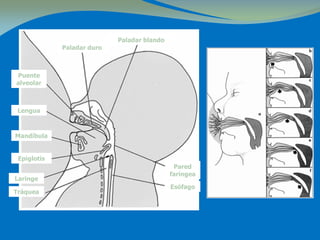 Paladar duro
Paladar blando
Puente
alveolar
Lengua
Mandíbula
Epiglotis
Laringe
Tráquea
Pared
faríngea
Esófago
 