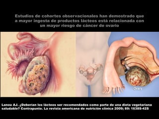 Estudios de cohortes observacionales han demostrado que
a mayor ingesta de productos lácteos está relacionada con
un mayor riesgo de cáncer de ovario
Lanou AJ. ¿Deberían los lácteos ser recomendados como parte de una dieta vegetariana
saludable? Contrapunto. La revista americana de nutrición clínica 2009; 89: 1638S-42S
 
