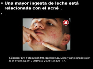 • Una mayor ingesta de leche está
relacionada con el acné .
• .
1.Spencer EH, Ferdowsian HR, Barnard ND. Dieta y acné: una revisión
de la evidencia. Int J Dermatol 2009; 48: 339 - 47.
 
