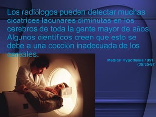 Los radiólogos pueden detectar muchas
cicatrices lacunares diminutas en los
cerebros de toda la gente mayor de años.
Algunos científicos creen que esto se
debe a una cocción inadecuada de los
cereales.
Medical Hypothesis 1991
(35:85-87
 