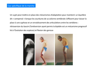 Cas	
  spéciﬁque	
  de	
  la	
  marche	
  
Un	
  sujet	
  peut	
  meQre	
  en	
  place	
  des	
  mécanismes	
  d’adapta(on	
  pour	
  maintenir	
  un	
  équilibre	
  
dit	
  «	
  compensé	
  »	
  lorsque	
  les	
  courbures	
  de	
  sa	
  colonne	
  vertébrale	
  s’eﬀacent	
  pour	
  laisser	
  la	
  
place	
  à	
  une	
  cyphose	
  et	
  un	
  enraidissement	
  des	
  ar(cula(ons	
  entre	
  les	
  vertèbres	
  :	
  
rétroversion	
  du	
  bassin	
  (l’antéversion	
  ayant	
  permis	
  la	
  bipédie	
  est	
  un	
  mécanisme	
  progressif	
  
lié	
  à	
  l’Evolu(on	
  des	
  espèces)	
  et	
  ﬂexion	
  des	
  genoux	
  
 