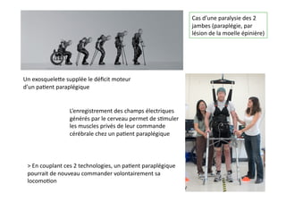 Un	
  exosqueleQe	
  supplée	
  le	
  déﬁcit	
  moteur	
  	
  
d’un	
  pa(ent	
  paraplégique	
  
L’enregistrement	
  des	
  champs	
  électriques	
  
générés	
  par	
  le	
  cerveau	
  permet	
  de	
  s(muler	
  
les	
  muscles	
  privés	
  de	
  leur	
  commande	
  
cérébrale	
  chez	
  un	
  pa(ent	
  paraplégique	
  
>	
  En	
  couplant	
  ces	
  2	
  technologies,	
  un	
  pa(ent	
  paraplégique	
  
pourrait	
  de	
  nouveau	
  commander	
  volontairement	
  sa	
  
locomo(on	
  
Cas	
  d’une	
  paralysie	
  des	
  2	
  
jambes	
  (paraplégie,	
  par	
  
lésion	
  de	
  la	
  moelle	
  épinière)	
  
 