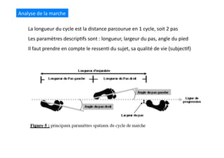 Analyse	
  de	
  la	
  marche	
  
La	
  longueur	
  du	
  cycle	
  est	
  la	
  distance	
  parcourue	
  en	
  1	
  cycle,	
  soit	
  2	
  pas	
  
Les	
  paramètres	
  descrip(fs	
  sont	
  :	
  longueur,	
  largeur	
  du	
  pas,	
  angle	
  du	
  pied	
  
Il	
  faut	
  prendre	
  en	
  compte	
  le	
  ressen(	
  du	
  sujet,	
  sa	
  qualité	
  de	
  vie	
  (subjec(f)	
  	
  
 