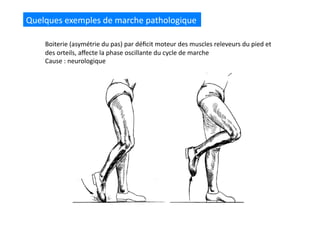 Quelques	
  exemples	
  de	
  marche	
  pathologique	
  
Boiterie	
  (asymétrie	
  du	
  pas)	
  par	
  déﬁcit	
  moteur	
  des	
  muscles	
  releveurs	
  du	
  pied	
  et	
  
des	
  orteils,	
  aﬀecte	
  la	
  phase	
  oscillante	
  du	
  cycle	
  de	
  marche	
  
Cause	
  :	
  neurologique	
  
 