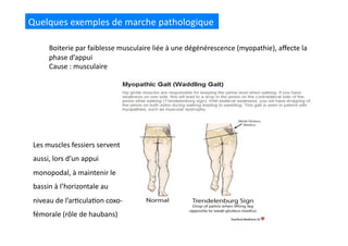 Quelques	
  exemples	
  de	
  marche	
  pathologique	
  
Boiterie	
  par	
  faiblesse	
  musculaire	
  liée	
  à	
  une	
  dégénérescence	
  (myopathie),	
  aﬀecte	
  la	
  
phase	
  d’appui	
  
Cause	
  :	
  musculaire	
  
Les	
  muscles	
  fessiers	
  servent	
  
aussi,	
  lors	
  d’un	
  appui	
  
monopodal,	
  à	
  maintenir	
  le	
  
bassin	
  à	
  l’horizontale	
  au	
  
niveau	
  de	
  l’ar(cula(on	
  coxo-­‐
fémorale	
  (rôle	
  de	
  haubans)	
  
 