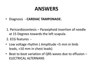 Paraxiphoid La lutte clincal case round 2019 | PPTX