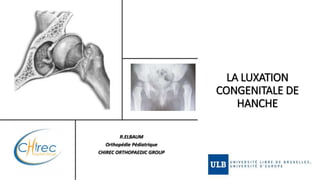 LA LUXATION
CONGENITALE DE
HANCHE
R.ELBAUM
Orthopédie Pédiatrique
CHIREC ORTHOPAEDIC GROUP
 