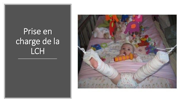 La Luxation Congenitale De La Hanche La Luxation Congenitale De La Hanche