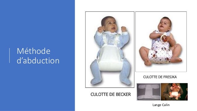 La Luxation Congenitale De La Hanche