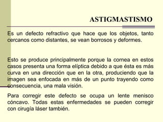 ASTIGMASTISMO
Es un defecto refractivo que hace que los objetos, tanto
cercanos como distantes, se vean borrosos y deformes.


Esto se produce principalmente porque la cornea en estos
casos presenta una forma elíptica debido a que ésta es más
curva en una dirección que en la otra, produciendo que la
imagen sea enfocada en más de un punto trayendo como
consecuencia, una mala visión.
Para corregir este defecto se ocupa un lente menisco
cóncavo. Todas estas enfermedades se pueden corregir
con cirugía láser también.
 