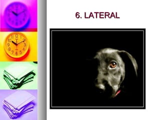 6. LATERAL