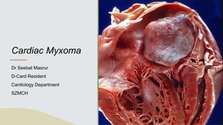 Cardiac Myxoma
Dr Seebat Masrur
D-Card Resident
Cardiology Department
SZMCH
 