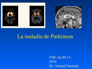 La maladie de Parkinson
FMC du 09-11-
2010
Dr. Arnaud Duretete
 