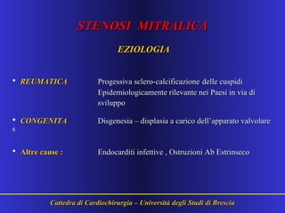 STENOSI MITRALICASTENOSI MITRALICA
EZIOLOGIAEZIOLOGIA
• REUMATICAREUMATICA Progessiva sclero-calcificazioneProgessiva sclero-calcificazione delle cuspididelle cuspidi
Epidemiologicamente rilevante nei Paesi in via diEpidemiologicamente rilevante nei Paesi in via di
svilupposviluppo
• CONGENITACONGENITA Disgenesia – displasia a carico dell’apparato valvolareDisgenesia – displasia a carico dell’apparato valvolare
ss
• Altre cause :Altre cause : Endocarditi infettive , Ostruzioni Ab EstrinsecoEndocarditi infettive , Ostruzioni Ab Estrinseco
Cattedra di Cardiochirurgia – Università degli Studi di BresciaCattedra di Cardiochirurgia – Università degli Studi di Brescia
 