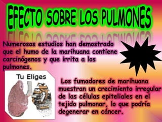 Numerosos estudios han demostrado
que el humo de la marihuana contiene
carcinógenos y que irrita a los
pulmones.

                  Los fumadores de marihuana
                 muestran un crecimiento irregular
                 de las células epiteliales en el
                 tejido pulmonar, lo que podría
                 degenerar en cáncer.
 