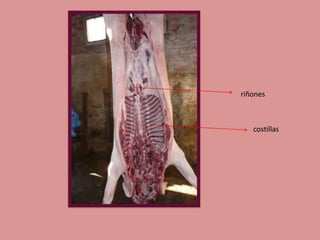 riñones

costillas

 