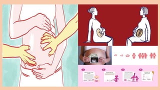 La maternidad subrogada