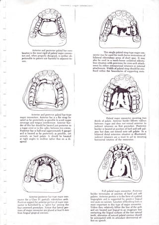 Posterier Strap Rpd Lambeth college removable partial dentures | PDF