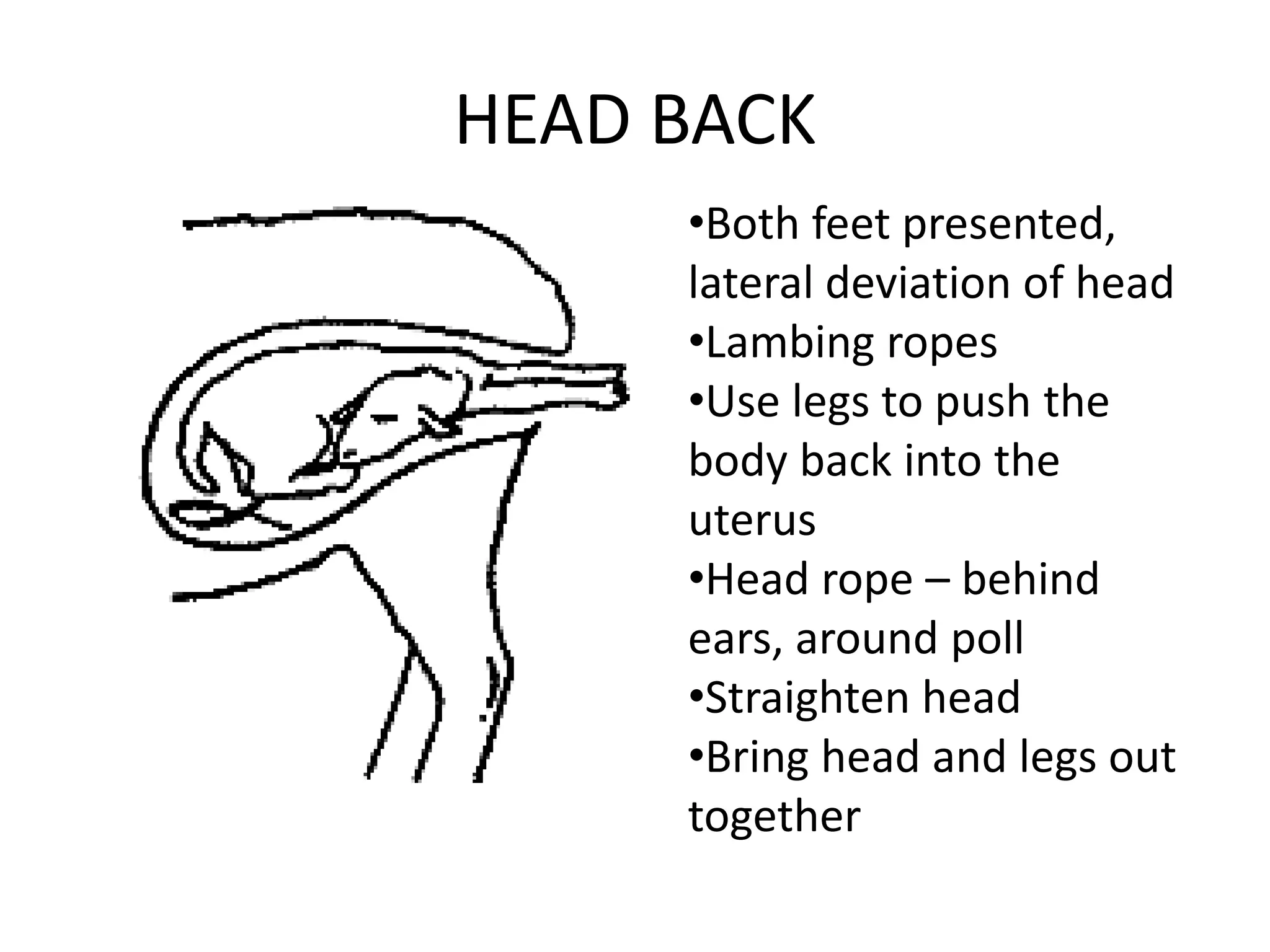 HEAD BACK
•Both feet presented,
lateral deviation of head
•Lambing ropes
•Use legs to push the
body back into the
uterus
•Head rope – behind
ears, around poll
•Straighten head
•Bring head and legs out
together
 