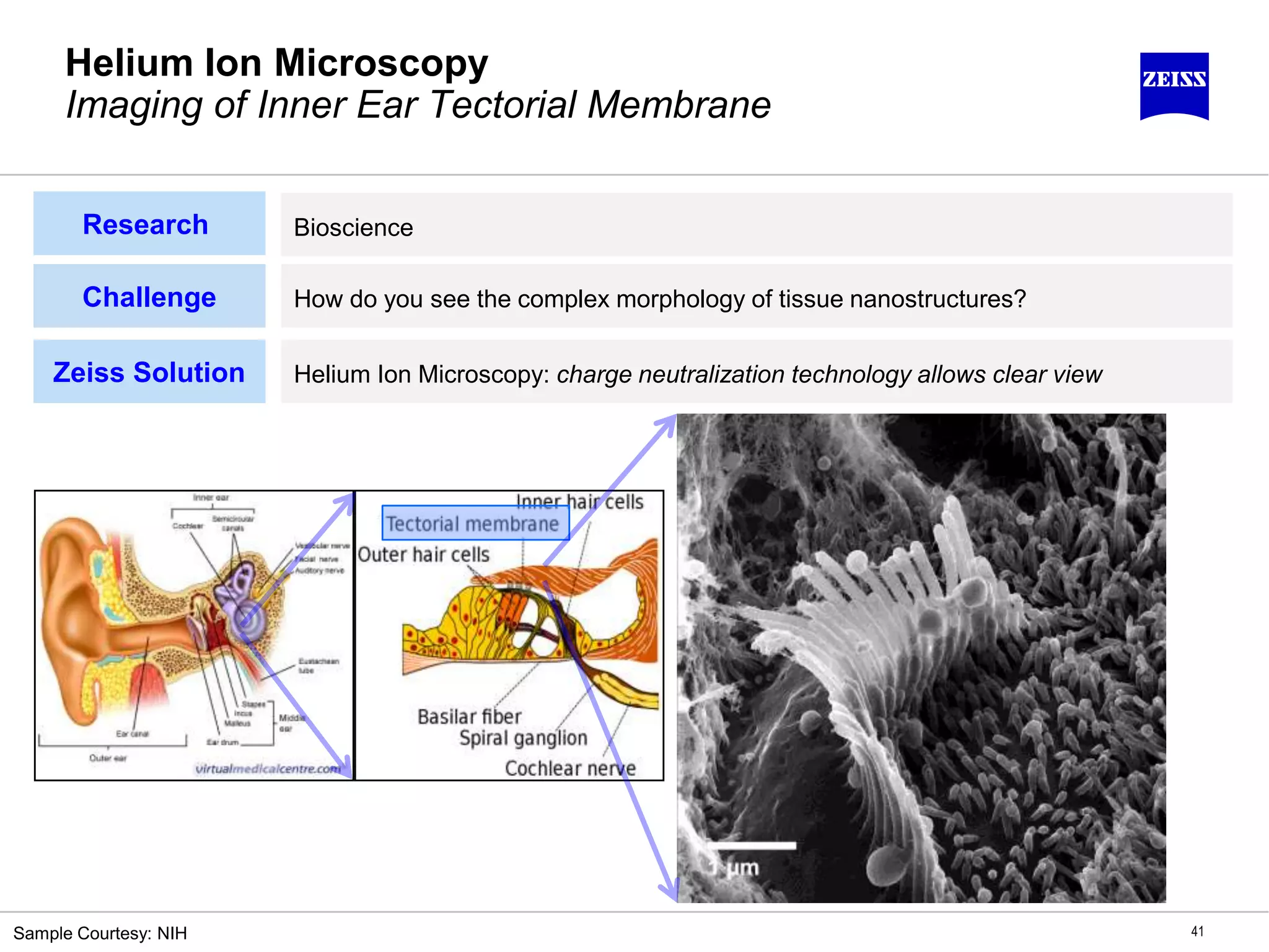 Helium Ion Microscopy
Imaging of Inner Ear Tectorial Membrane
41
Bioscience
Challenge How do you see the complex morphology of tissue nanostructures?
Zeiss Solution Helium Ion Microscopy: charge neutralization technology allows clear view
Sample Courtesy: NIH
Research
 