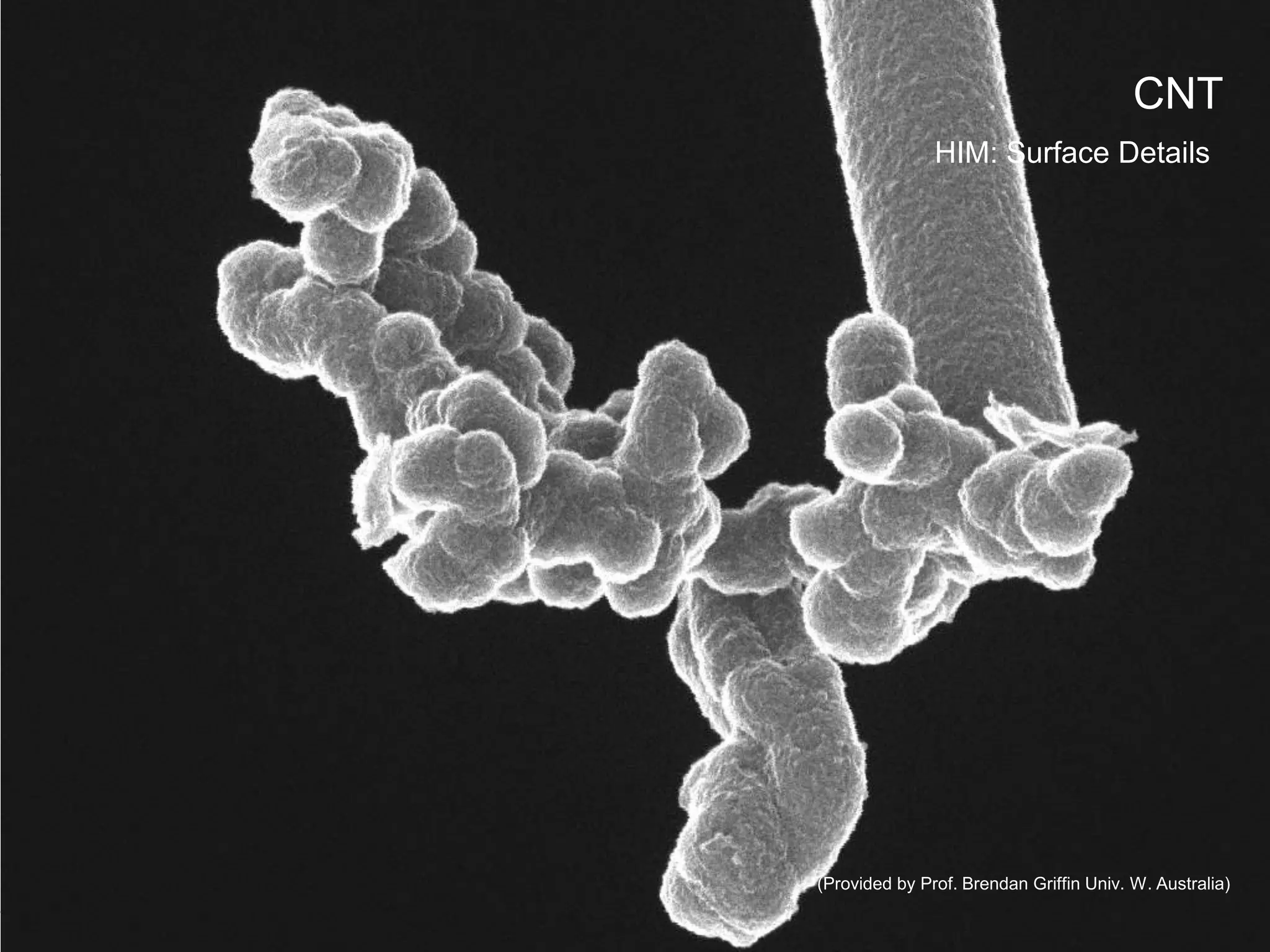 (Provided by Prof. Brendan Griffin Univ. W. Australia)
CNT
HIM: Surface Details
 