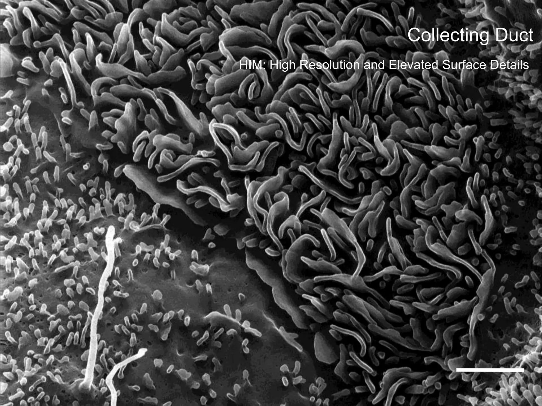 9/20/2012 72Carl Zeiss NTS LLC , Bernhard Goetze
Collecting Duct
HIM: High Resolution and Elevated Surface Details
 