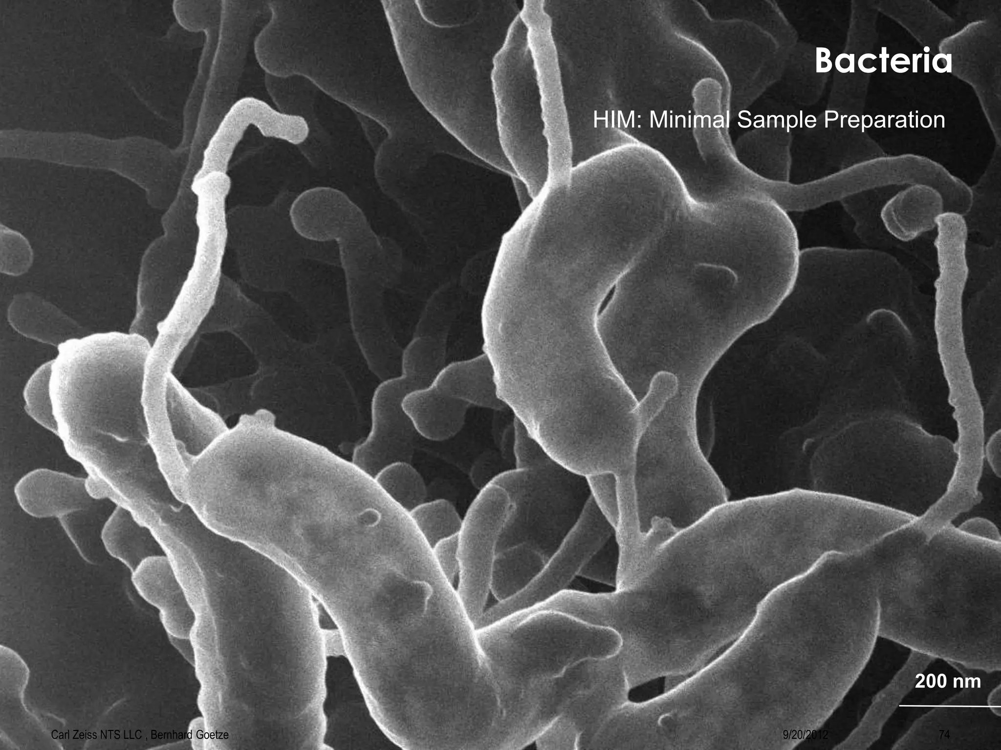 Bacteria
9/20/2012 74Carl Zeiss NTS LLC , Bernhard Goetze
200 nm
HIM: Minimal Sample Preparation
 