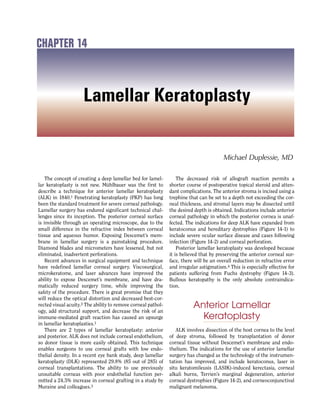 The concept of creating a deep lamellar bed for lamel-
lar keratoplasty is not new. Mühlbauer was the first to
describe a technique for anterior lamellar keratoplasty
(ALK) in 1840.1 Penetrating keratoplasty (PKP) has long
been the standard treatment for severe corneal pathology.
Lamellar surgery has endured significant technical chal-
lenges since its inception. The posterior corneal surface
is invisible through an operating microscope, due to the
small difference in the refractive index between corneal
tissue and aqueous humor. Exposing Descemet’s mem-
brane in lamellar surgery is a painstaking procedure.
Diamond blades and micrometers have lessened, but not
eliminated, inadvertent perforations.
Recent advances in surgical equipment and technique
have redefined lamellar corneal surgery. Viscosurgical,
microkeratome, and laser advances have improved the
ability to expose Descemet’s membrane, and have dra-
matically reduced surgery time, while improving the
safety of the procedure. There is great promise that they
will reduce the optical distortion and decreased best-cor-
rected visual acuity.2 The ability to remove corneal pathol-
ogy, add structural support, and decrease the risk of an
immune-mediated graft reaction has caused an upsurge
in lamellar keratoplasties.1
There are 2 types of lamellar keratoplasty: anterior
and posterior. ALK does not include corneal endothelium,
so donor tissue is more easily obtained. This technique
enables surgeons to use corneal grafts with low endo-
thelial density. In a recent eye bank study, deep lamellar
keratoplasty (DLK) represented 29.8% (85 out of 285) of
corneal transplantations. The ability to use previously
unsuitable corneas with poor endothelial function per-
mitted a 24.5% increase in corneal grafting in a study by
Muraine and colleagues.3
The decreased risk of allograft reaction permits a
shorter course of postoperative topical steroid and atten-
dant complications. The anterior stroma is incised using a
trephine that can be set to a depth not exceeding the cor-
neal thickness, and stromal layers may be dissected until
the desired depth is obtained. Indications include anterior
corneal pathology in which the posterior cornea is unaf-
fected. The indications for deep ALK have expanded from
keratoconus and hereditary dystrophies (Figure 14-1) to
include severe ocular surface disease and cases following
infection (Figure 14-2) and corneal perforation.
Posterior lamellar keratoplasty was developed because
it is believed that by preserving the anterior corneal sur-
face, there will be an overall reduction in refractive error
and irregular astigmatism.4 This is especially effective for
patients suffering from Fuchs dystrophy (Figure 14-3).
Bullous keratopathy is the only absolute contraindica-
tion.
Anterior Lamellar
Keratoplasty
ALK involves dissection of the host cornea to the level
of deep stroma, followed by transplantation of donor
corneal tissue without Descemet’s membrane and endo-
thelium. The indications for the use of anterior lamellar
surgery has changed as the technology of the instrumen-
tation has improved, and include keratoconus, laser in
situ keratomileusis (LASIK)-induced kerectasia, corneal
alkali burns, Terrien’s marginal degeneration, anterior
corneal dystrophies (Figure 14-2), and corneoconjunctival
malignant melanoma.
Michael Duplessie, MD
Lamellar Keratoplasty
CHAPTER 14
 