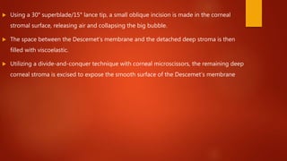  Using a 30° superblade/15° lance tip, a small oblique incision is made in the corneal
stromal surface, releasing air and collapsing the big bubble.
 The space between the Descemet’s membrane and the detached deep stroma is then
filled with viscoelastic.
 Utilizing a divide-and-conquer technique with corneal microscissors, the remaining deep
corneal stroma is excised to expose the smooth surface of the Descemet’s membrane
 