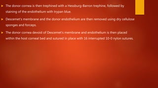  The donor cornea is then trephined with a Hessburg-Barron trephine, followed by
staining of the endothelium with trypan blue.
 Descemet’s membrane and the donor endothelium are then removed using dry cellulose
sponges and forceps.
 The donor cornea devoid of Descemet’s membrane and endothelium is then placed
within the host corneal bed and sutured in place with 16 interrupted 10-0 nylon sutures.
 