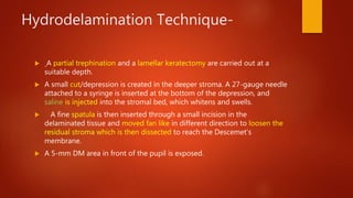 Hydrodelamination Technique-
 A partial trephination and a lamellar keratectomy are carried out at a
suitable depth.
 A small cut/depression is created in the deeper stroma. A 27-gauge needle
attached to a syringe is inserted at the bottom of the depression, and
saline is injected into the stromal bed, which whitens and swells.
 A fine spatula is then inserted through a small incision in the
delaminated tissue and moved fan like in different direction to loosen the
residual stroma which is then dissected to reach the Descemet’s
membrane.
 A 5-mm DM area in front of the pupil is exposed.
 