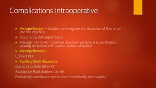 Complications Intraoperative
 Microperforation – Sudden softening eye and excursion of fluid or air
into the interface.
 Occurrence 39% expert hand
 Manage – Air in AC- Continue dissection peripheral to perforation.
Leaving Air bubble with supine position of patient
 Macroperforation –
Convert PKP
 Pupillary Block Glaucoma-
due to air bubble left in AC
Avoided by Pupil dilation if air left
Periodically examination eye in hour immediately after surgery
 
